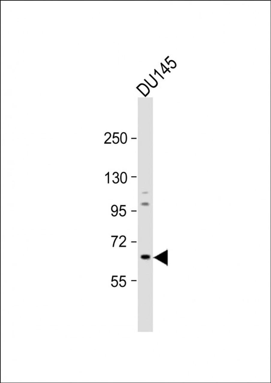 Western Blot at 1:1000 dilution + DU145 whole cell lysate Lysates/proteins at 20 ug per lane.
