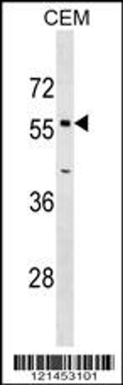 Western blot analysis in CEM cell line lysates (35ug/lane) .