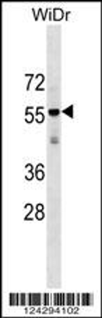 Western blot analysis in WiDr cell line lysates (35ug/lane) .