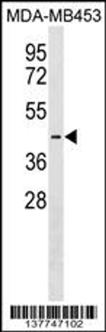 Western blot analysis in MDA-MB453 cell line lysates (35ug/lane) .