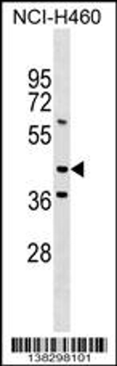 Western blot analysis in NCI-H460 cell line lysates (35ug/lane) .