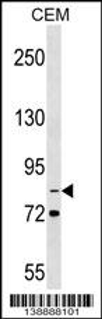 Western blot analysis in CEM cell line lysates (35ug/lane) .