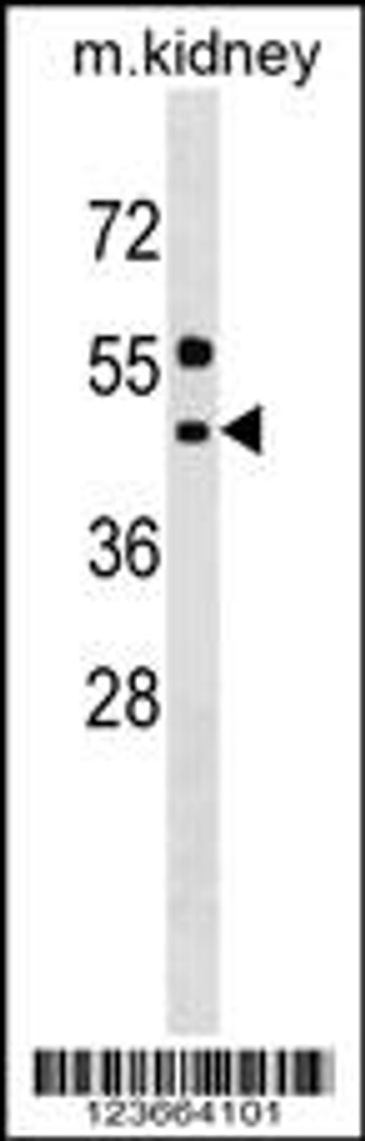 Western blot analysis in mouse kidney tissue lysates (35ug/lane) .