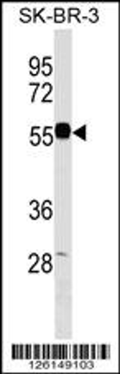 Western blot analysis in SK-BR-3 cell line lysates (35ug/lane) .