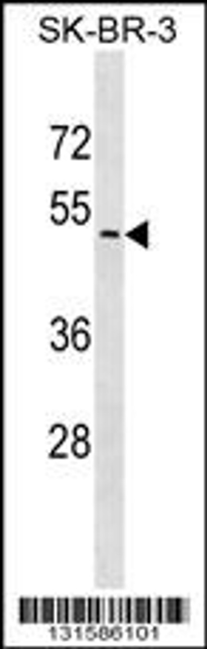 Western blot analysis in SK-BR-3 cell line lysates (35ug/lane) .