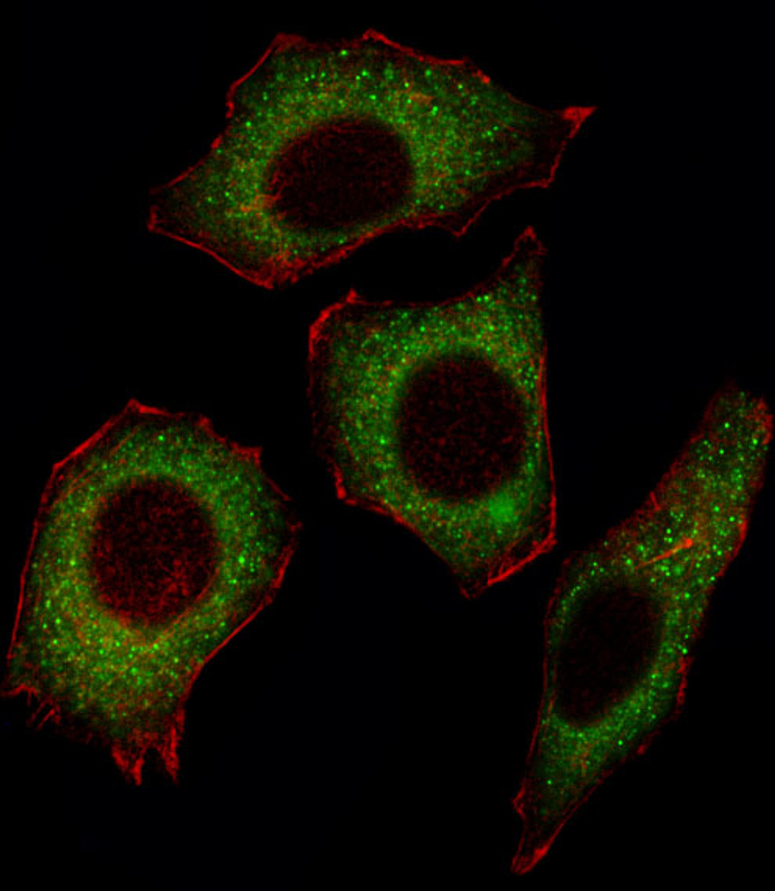 Fluorescent image of U251 cell stained with NFKBp65 Antibody (C-termS536) .U251 cells were fixed with 4% PFA (20 min) , permeabilized with Triton X-100 (0.1%, 10 min) , then incubated with NFKBp65 primary antibody (1:25) . For secondary antibody, Alexa Fluor 488 conjugated donkey anti-rabbit antibody (green) was used (1:400) .Cytoplasmic actin was counterstained with Alexa Fluor 555 (red) conjugated Phalloidin (7units/ml) .NFKBp65 immunoreactivity is localized to Cytoplasm significantly.