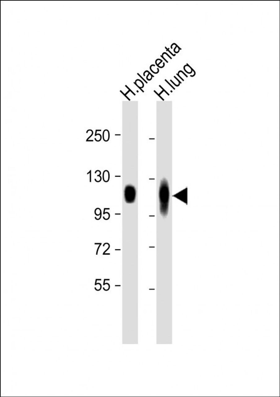 Western Blot at 1:8000 dilution Lane 1: H. placenta whole lysate Lane 2: H. lung whole lysate Lysates/proteins at 20 ug per lane.