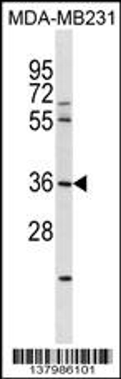 Western blot analysis in MDA-MB231 cell line lysates (35ug/lane) .