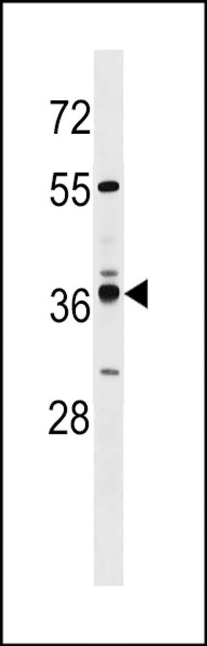 Western blot analysis in MDA-MB231 cell line lysates (35ug/lane) .
