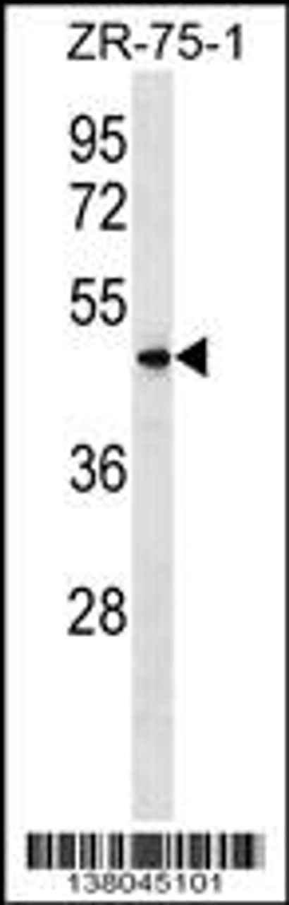 Western blot analysis in ZR-75-1 cell line lysates (35ug/lane) .