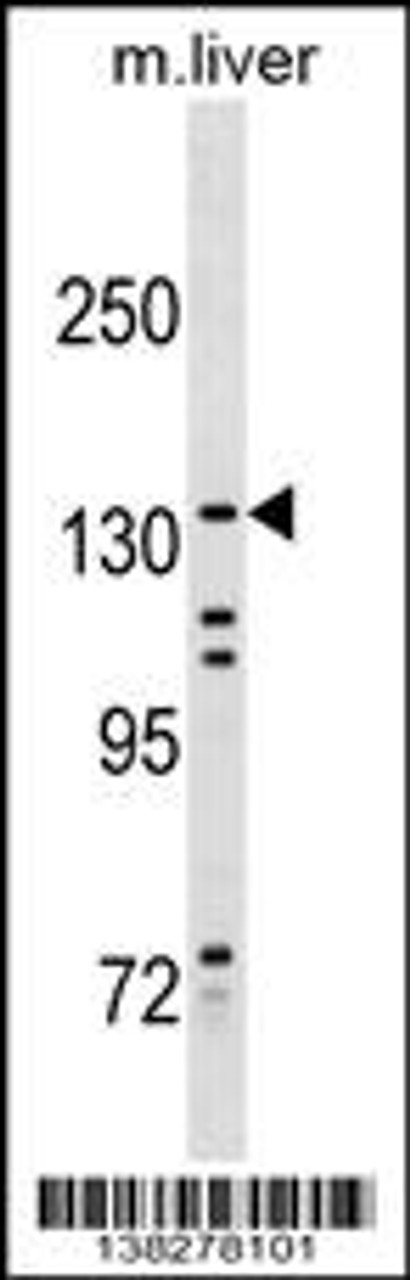 Western blot analysis in mouse liver tissue lysates (35ug/lane) .