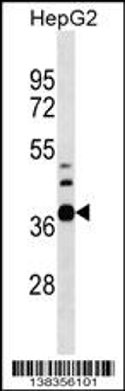 Western blot analysis in HepG2 cell line lysates (35ug/lane) .