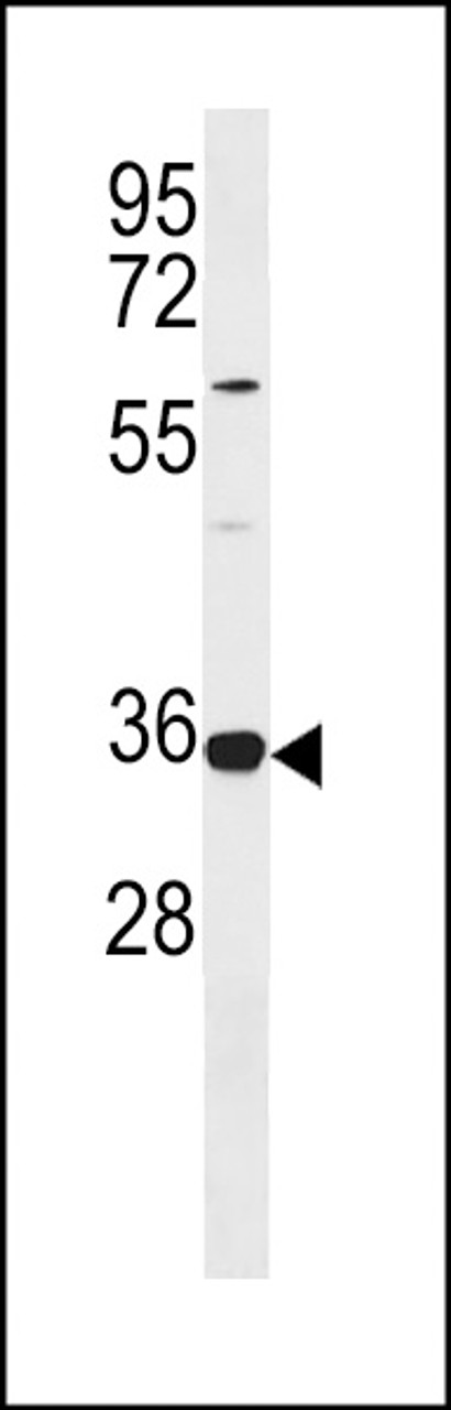 Western blot analysis in Jurkat cell line lysates (35ug/lane) .