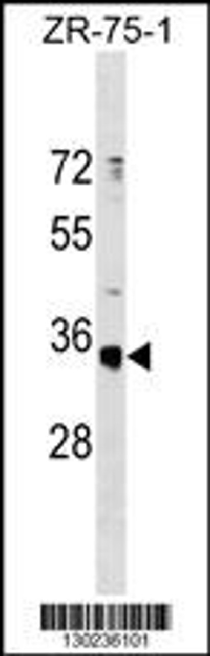 Western blot analysis in ZR-75-1 cell line lysates (35ug/lane) .