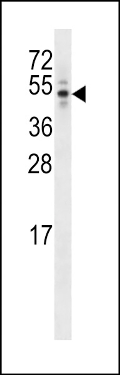 Western blot analysis in T47D cell line lysates (35ug/lane) .