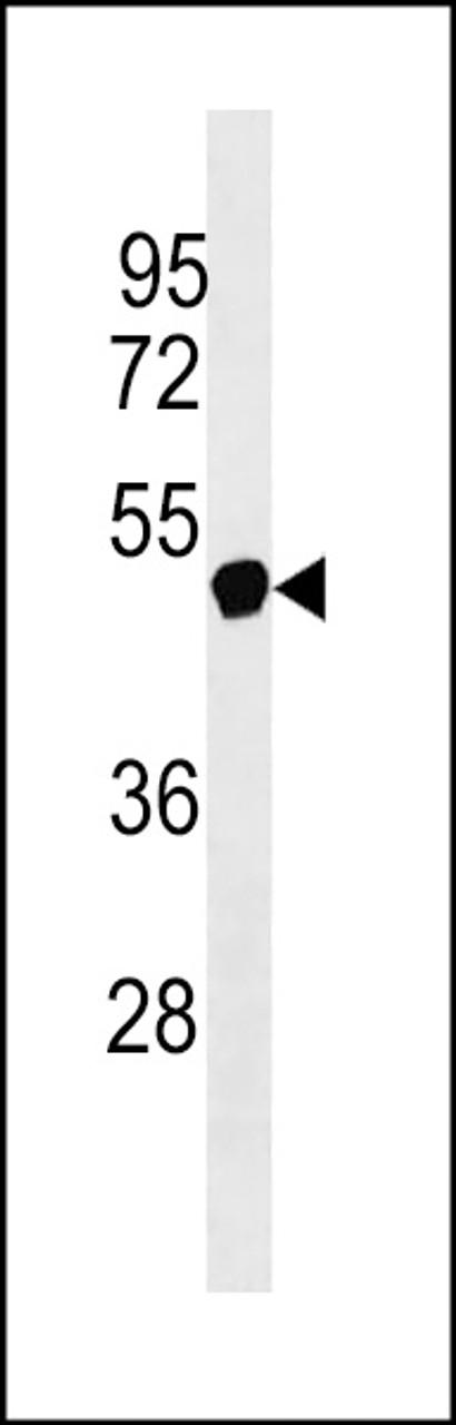 Western blot analysis in Jurkat cell line lysates (35ug/lane) .