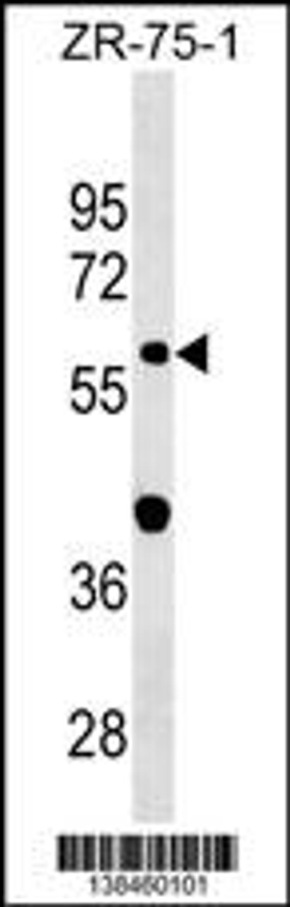 Western blot analysis in ZR-75-1 cell line lysates (35ug/lane) .