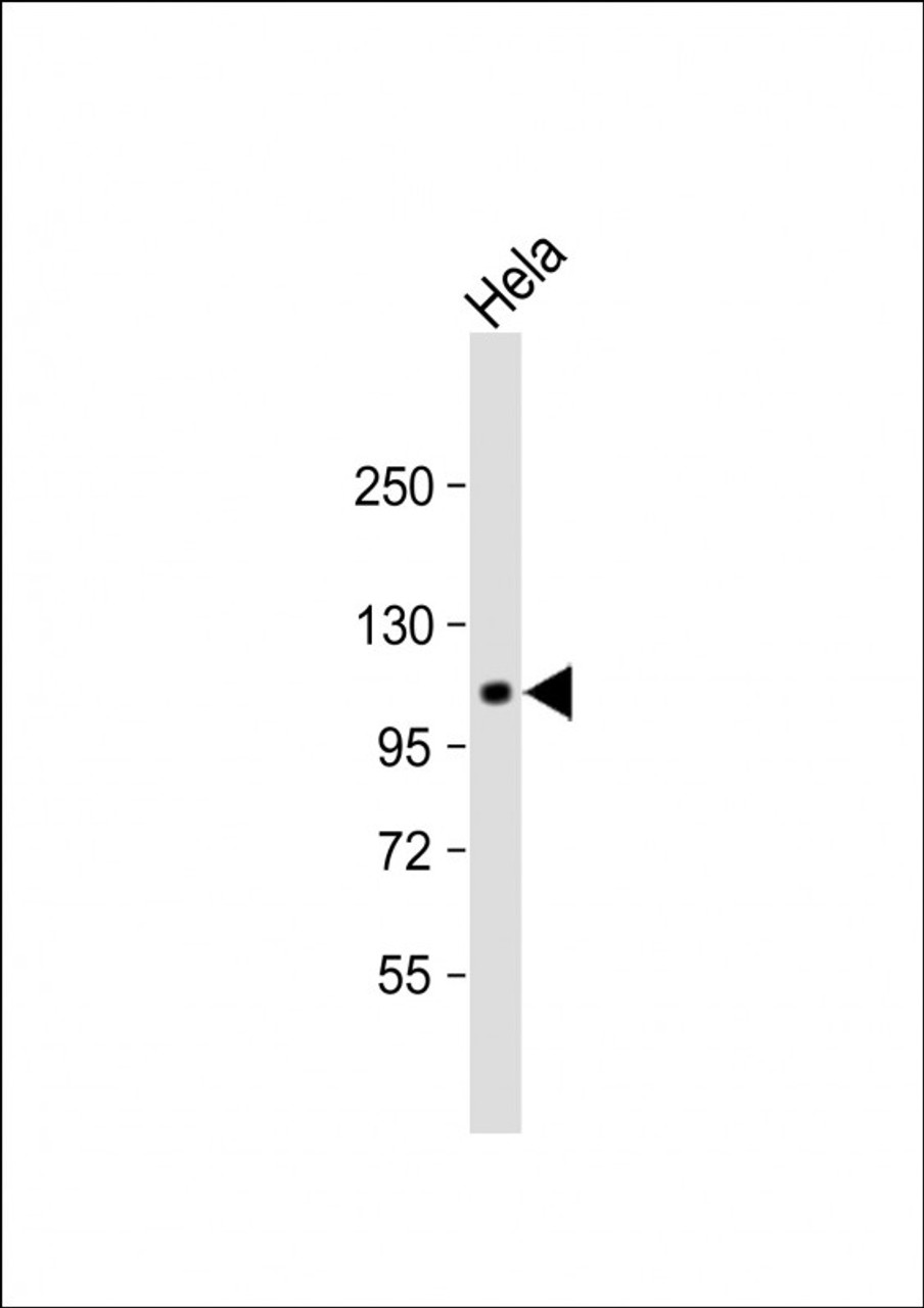 Western Blot at 1:1000 dilution + Hela whole cell lysate Lysates/proteins at 20 ug per lane.