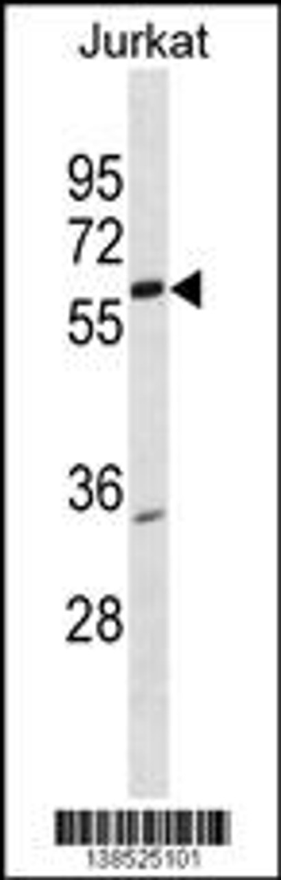 Western blot analysis in Jurkat cell line lysates (35ug/lane) .