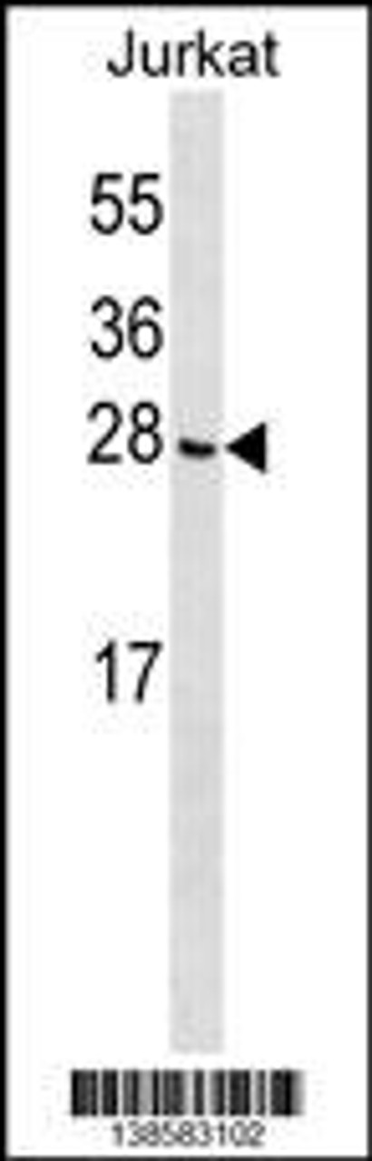 Western blot analysis in Jurkat cell line lysates (35ug/lane) .