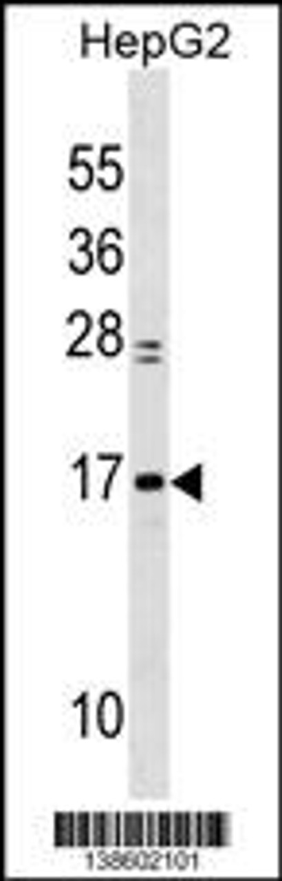 Western blot analysis in HepG2 cell line lysates (35ug/lane) .