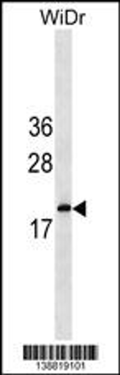 Western blot analysis in WiDr cell line lysates (35ug/lane) .