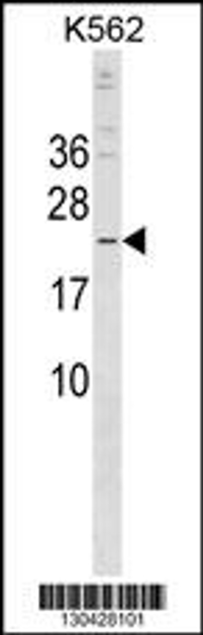 Western blot analysis in K562 cell line lysates (35ug/lane) .