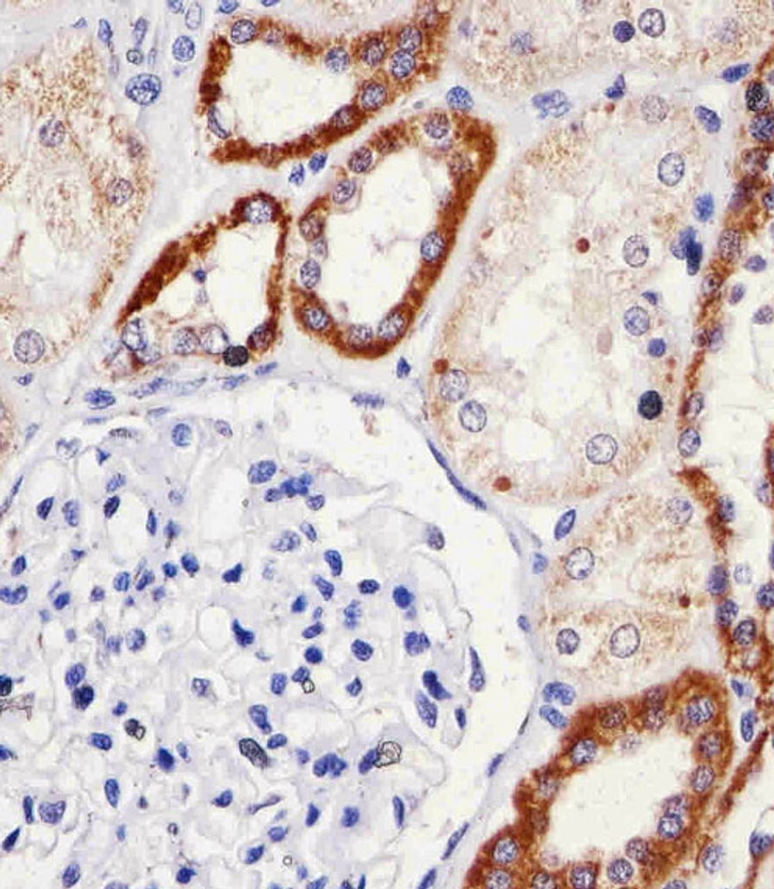 Immunohistochemical analysis of paraffin-embedded H. kideny section using SNX3 Antibody . Antibody was diluted at 1:25 dilution. A undiluted biotinylated goat polyvalent antibody was used as the secondary, followed by DAB staining.