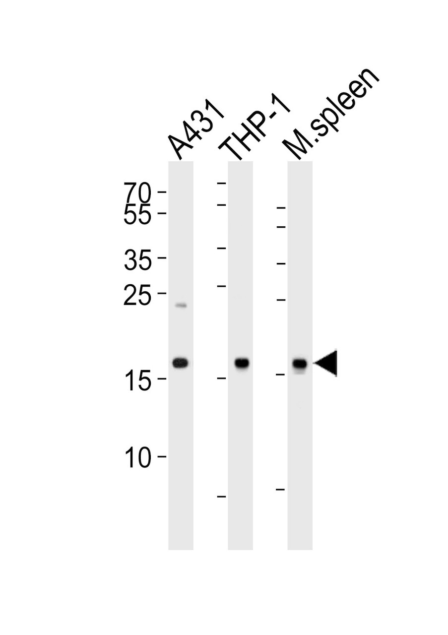 Western blot analysis of lysates from A431, THP-1 cell line and mouse spleen tissue lysate (from left to right) , using SNX3 Antibody at 1:1000 at each lane.