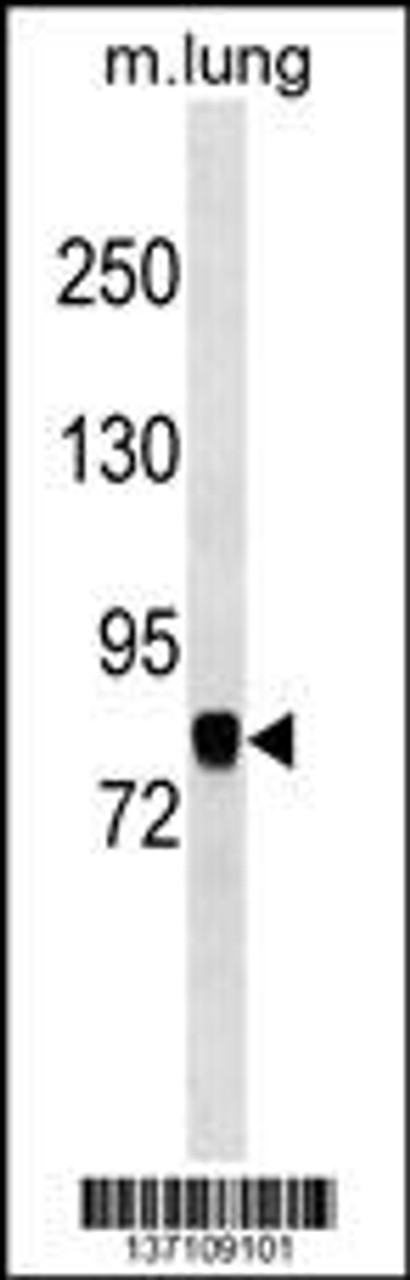 Western blot analysis in mouse lung tissue lysates (35ug/lane) .