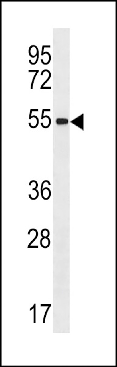 Western blot analysis in MDA-MB468 cell line lysates (35ug/lane) .