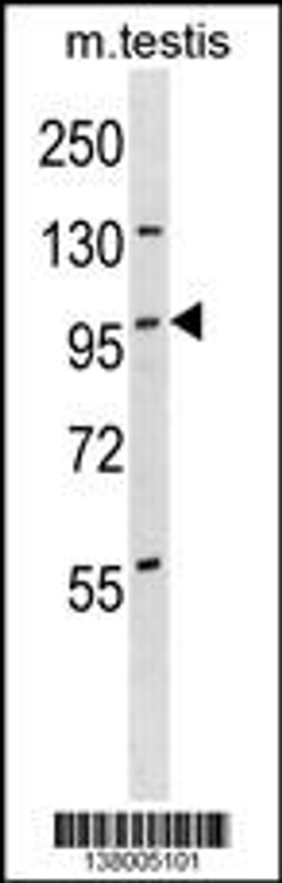 Western blot analysis in mouse testis tissue lysates (35ug/lane) .