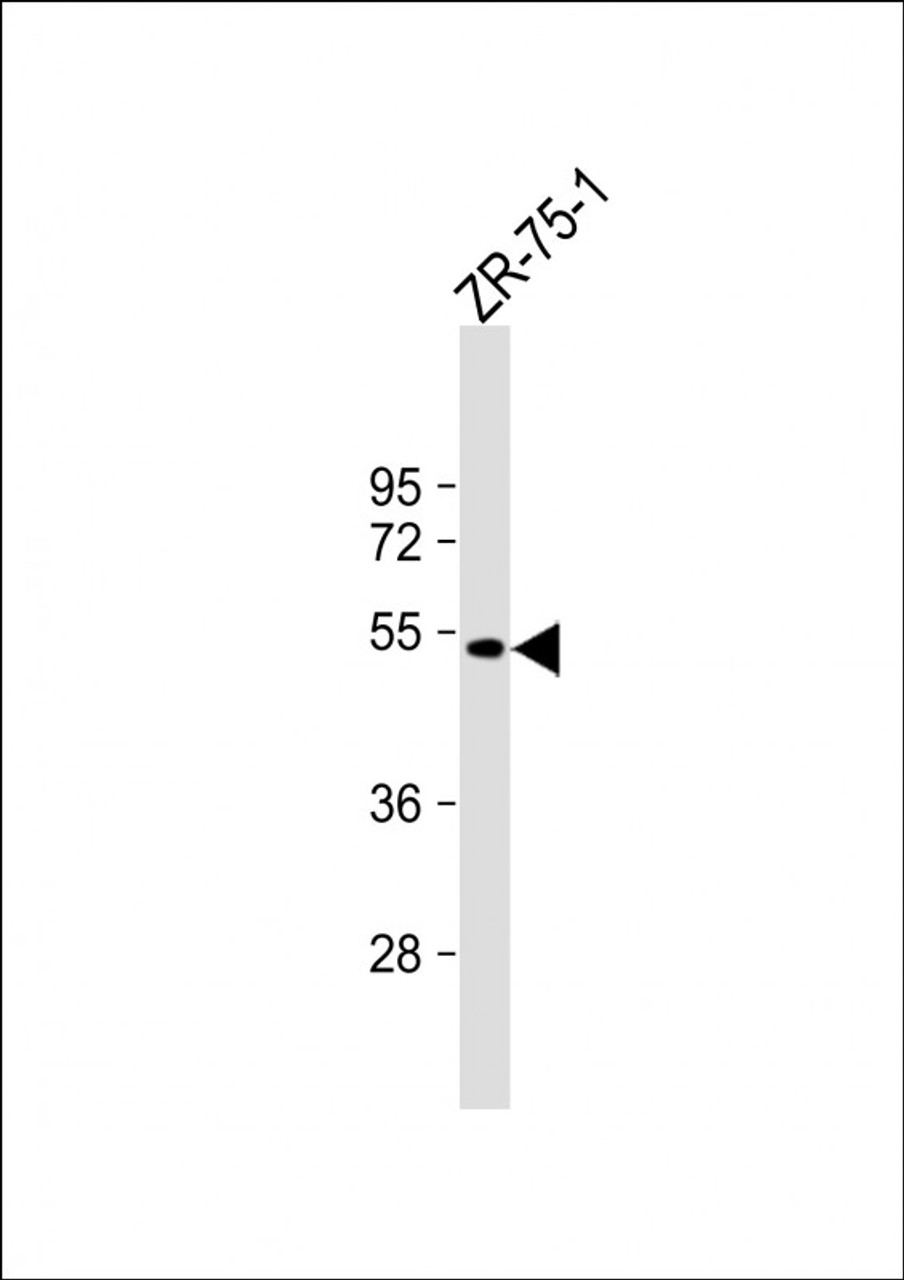 Western Blot at 1:1000 dilution + ZR-75-1 whole cell lysate Lysates/proteins at 20 ug per lane.