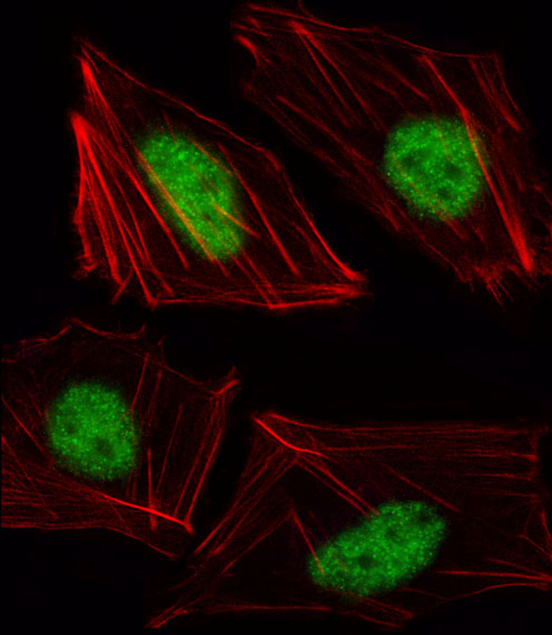 Fluorescent image of HUVEC cell stained with TBX15 Antibody (N-term) .HUVEC cells were fixed with 4% PFA (20 min) , permeabilized with Triton X-100 (0.1%, 10 min) , then incubated with TBX15 primary antibody (1:25) . For secondary antibody, Alexa Fluor 488 conjugated donkey anti-rabbit antibody (green) was used (1:400) .Cytoplasmic actin was counterstained with Alexa Fluor 555 (red) conjugated Phalloidin (7units/ml) .TBX15 immunoreactivity is localized to Nucleus significantly.