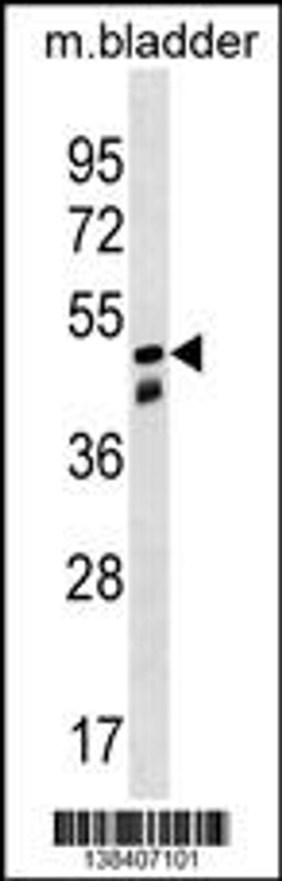 Western blot analysis in mouse bladder tissue lysates (35ug/lane) .