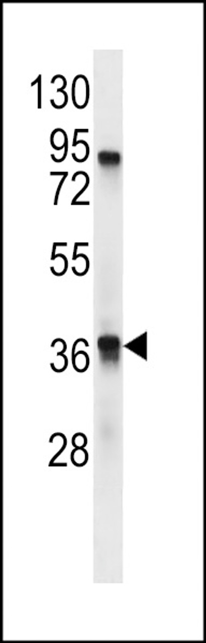 Western blot analysis in mouse stomach tissue lysates (35ug/lane) .