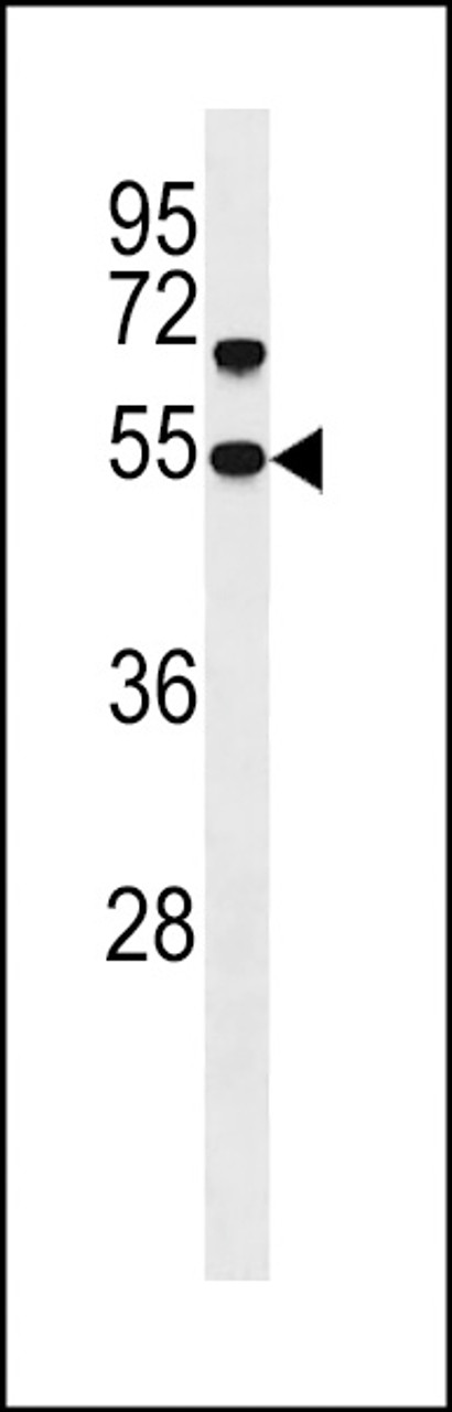 Western blot analysis in human placenta tissue lysates (35ug/lane) .