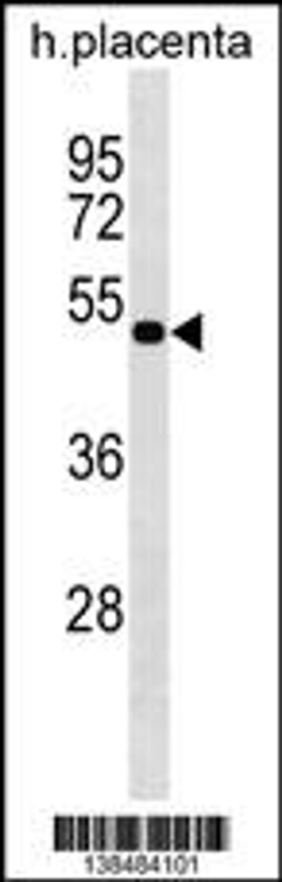 Western blot analysis in human placenta tissue lysates (35ug/lane) .