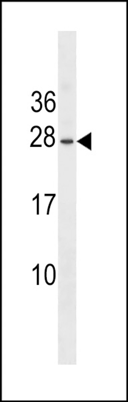 Western blot analysis in WiDr cell line lysates (35ug/lane) .This demonstrates the detected the Erythropoietin protein (arrow) .