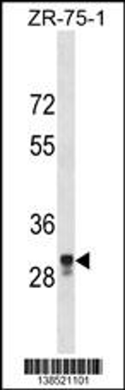 Western blot analysis in ZR-75-1 cell line lysates (35ug/lane) .