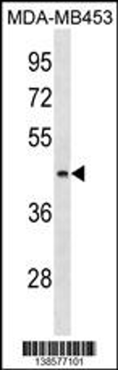 Western blot analysis in MDA-MB453 cell line lysates (35ug/lane) .