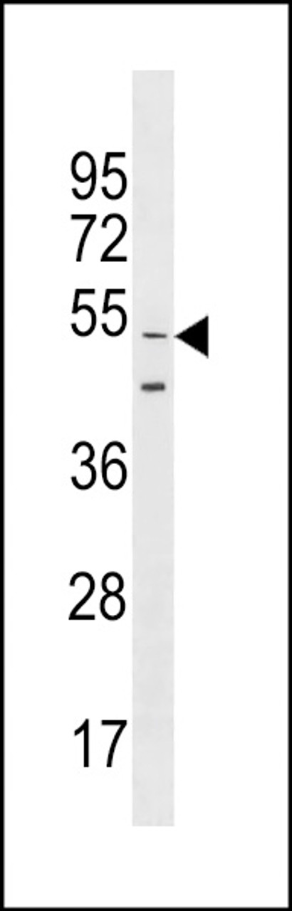 Western blot analysis in CEM cell line lysates (35ug/lane) .