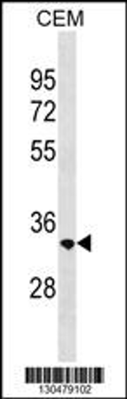 Western blot analysis in CEM cell line lysates (35ug/lane) .