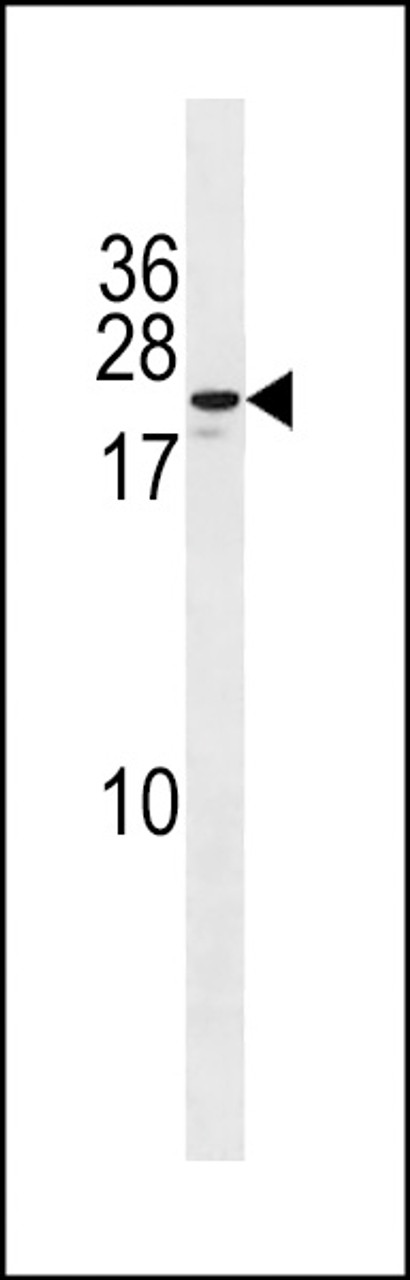 Western blot analysis in MDA-MB453 cell line lysates (35ug/lane) .