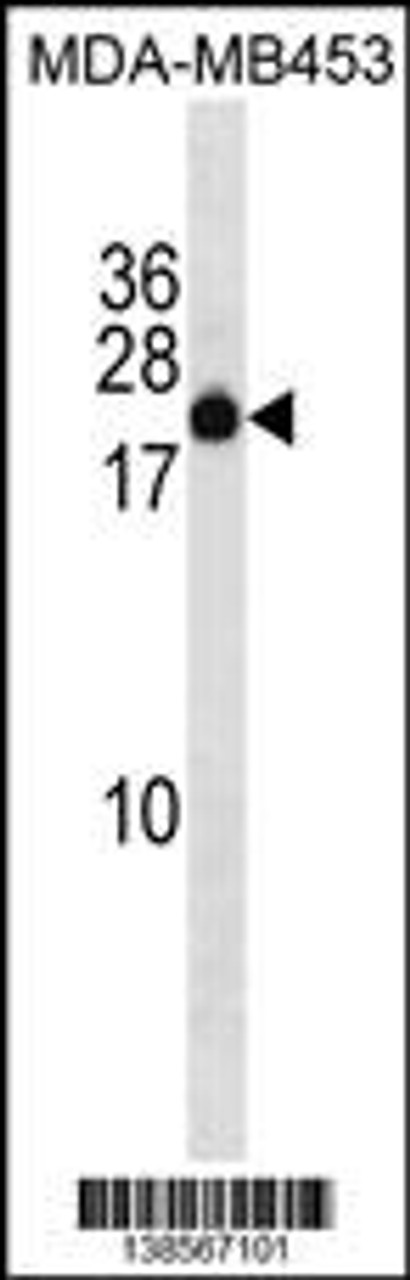 Western blot analysis in MDA-MB453 cell line lysates (35ug/lane) .