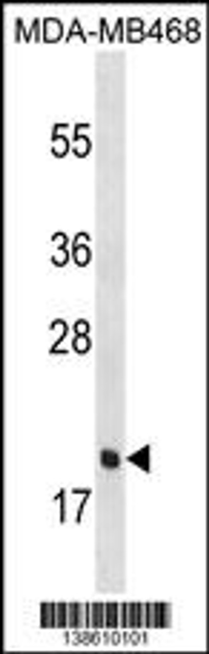 Western blot analysis in MDA-MB468 cell line lysates (35ug/lane) .