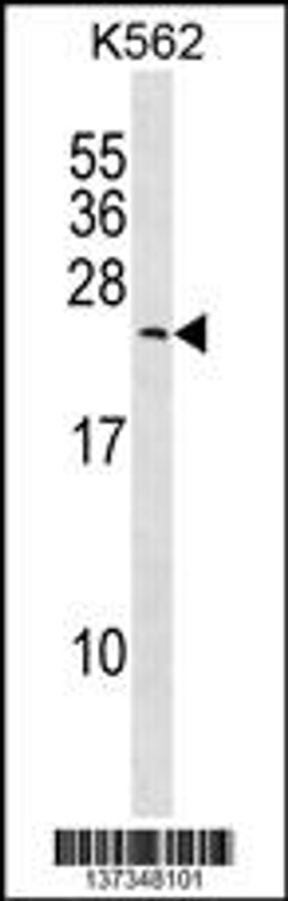 Western blot analysis in K562 cell line lysates (35ug/lane) .