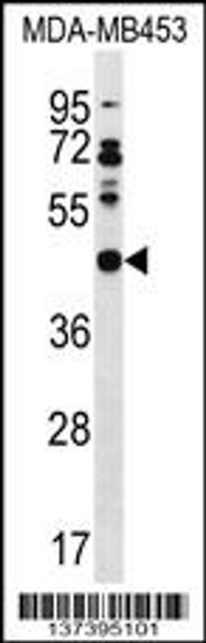 Western blot analysis in MDA-MB453 cell line lysates (35ug/lane) .