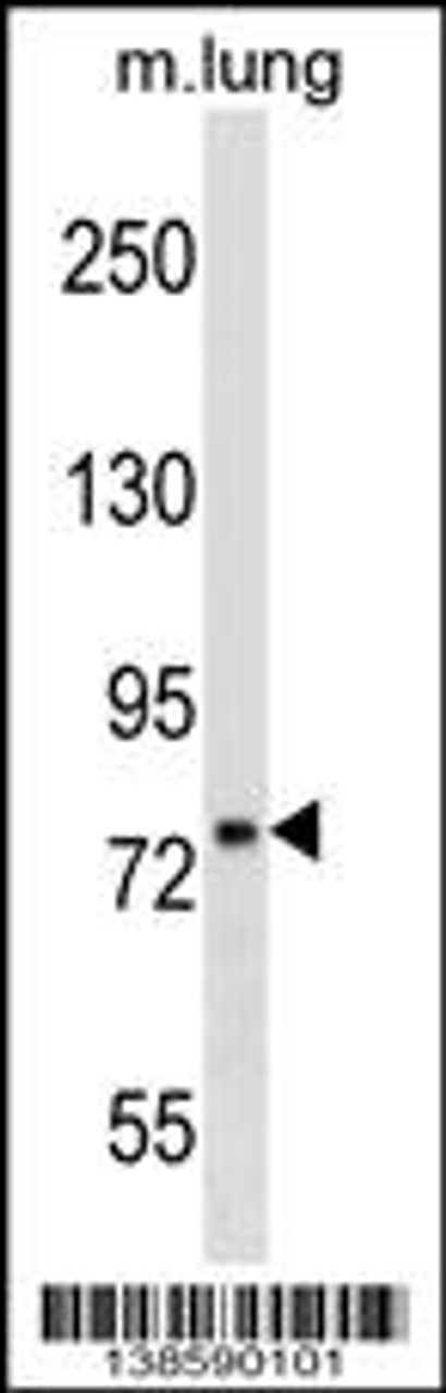 Western blot analysis in mouse lung tissue lysates (35ug/lane) .