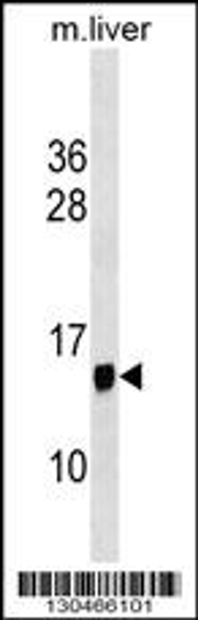 Western blot analysis in mouse liver tissue lysates (35ug/lane) .